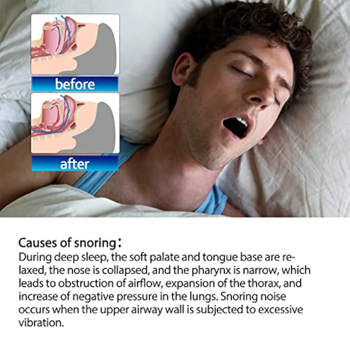 Anti Sleep snoring Patch Reusable(15 pack)