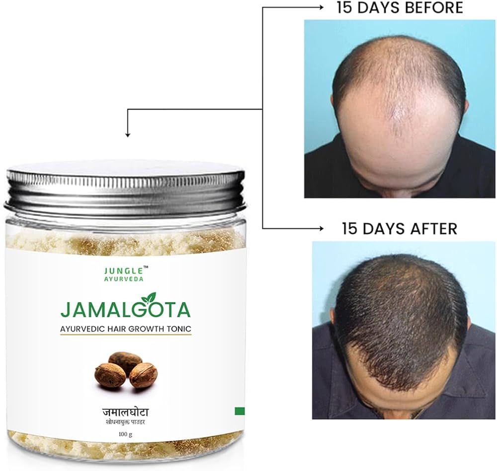 JamalGota Ayurvedic Hair Grwoth Tonic