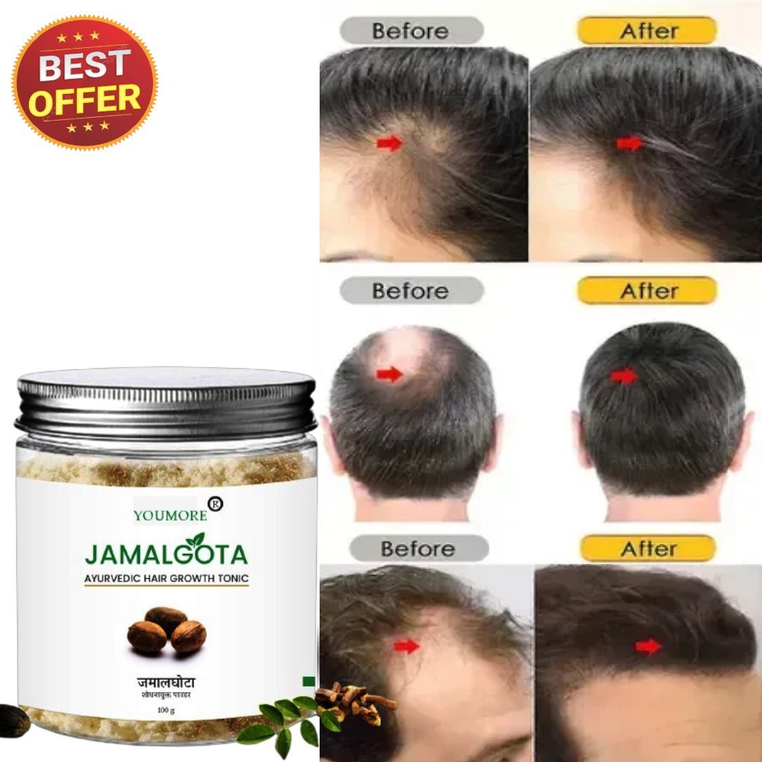 JamalGota Ayurvedic Hair Grwoth Tonic
