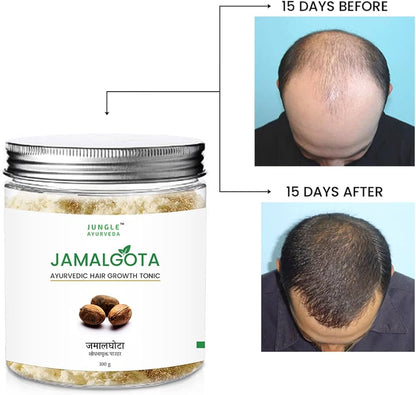 JamalGota Ayurvedic Hair Grwoth Tonic
