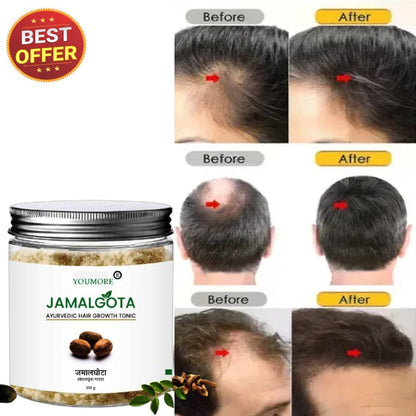 JamalGota Ayurvedic Hair Grwoth Tonic
